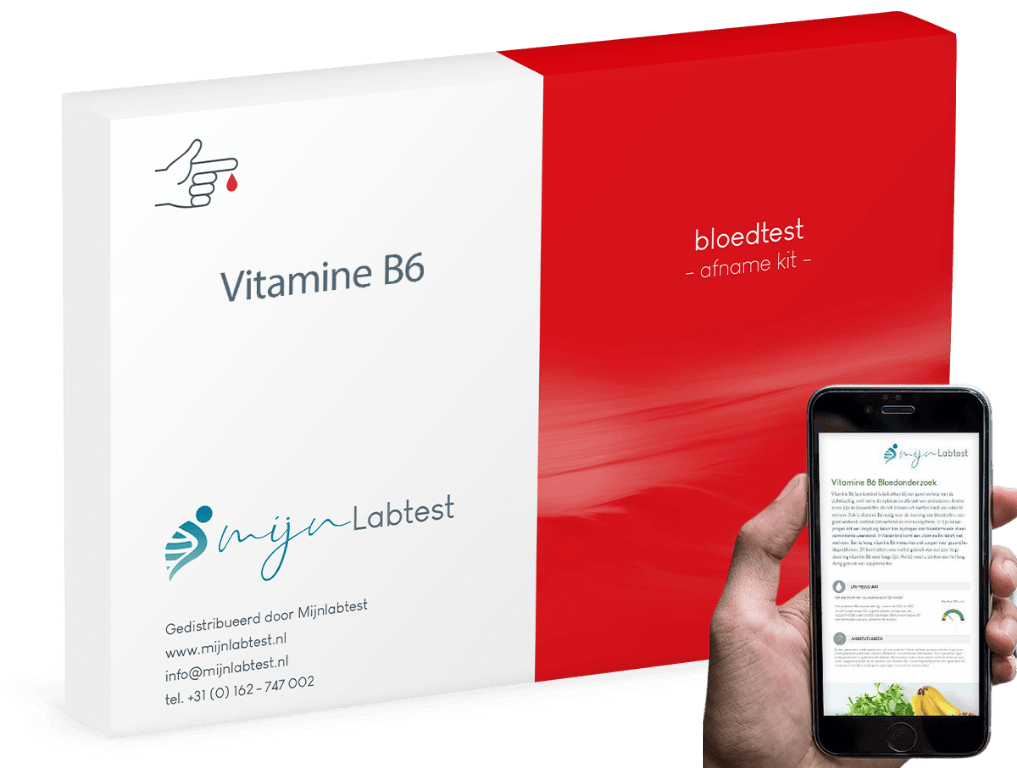 Vitamine B6 test