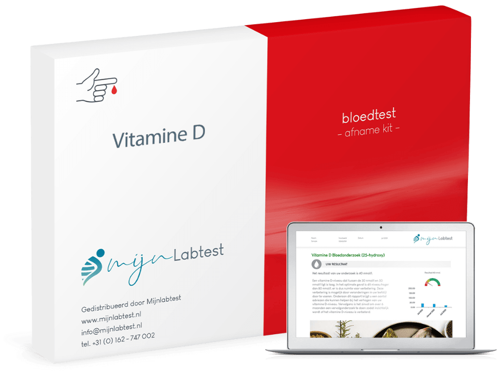 Vitamine D test