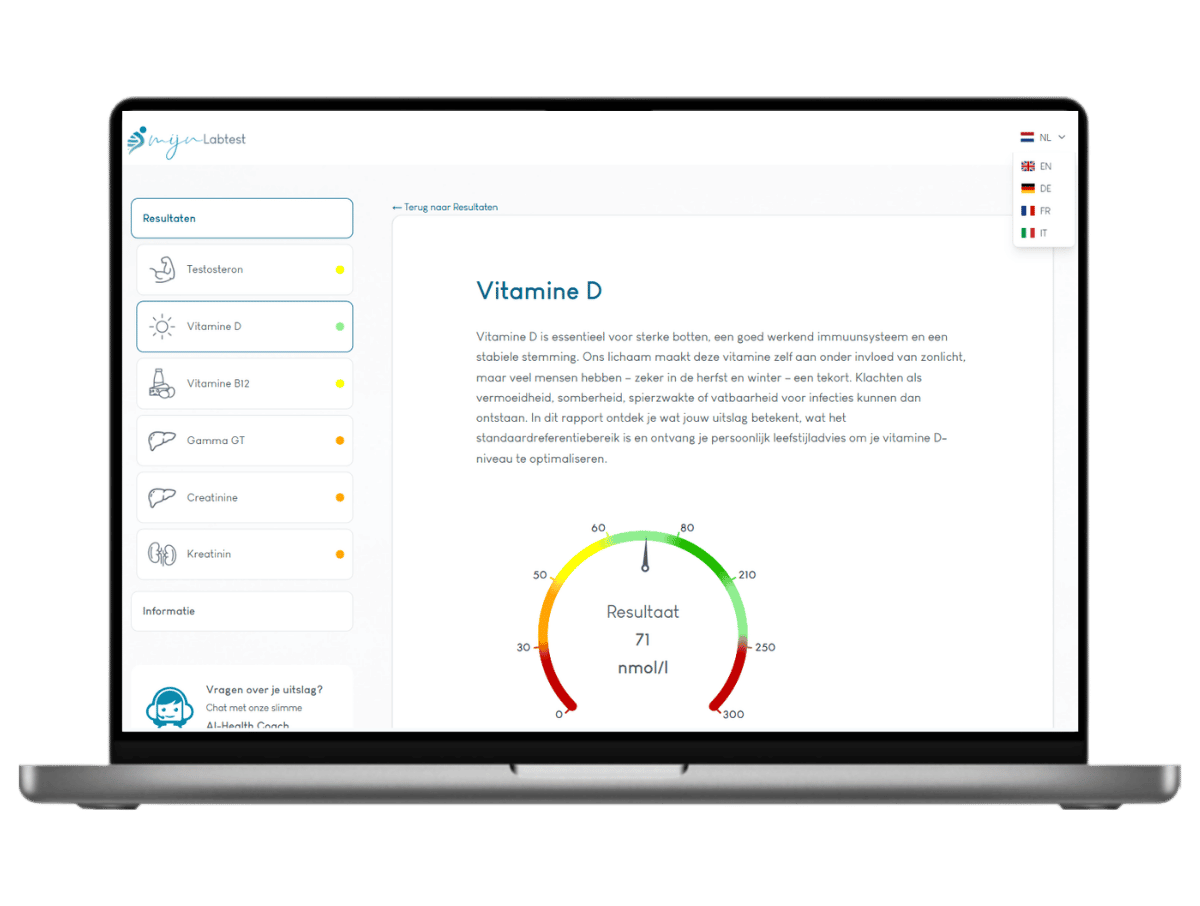 Zo ziet jou vitamine D resultaat eruit