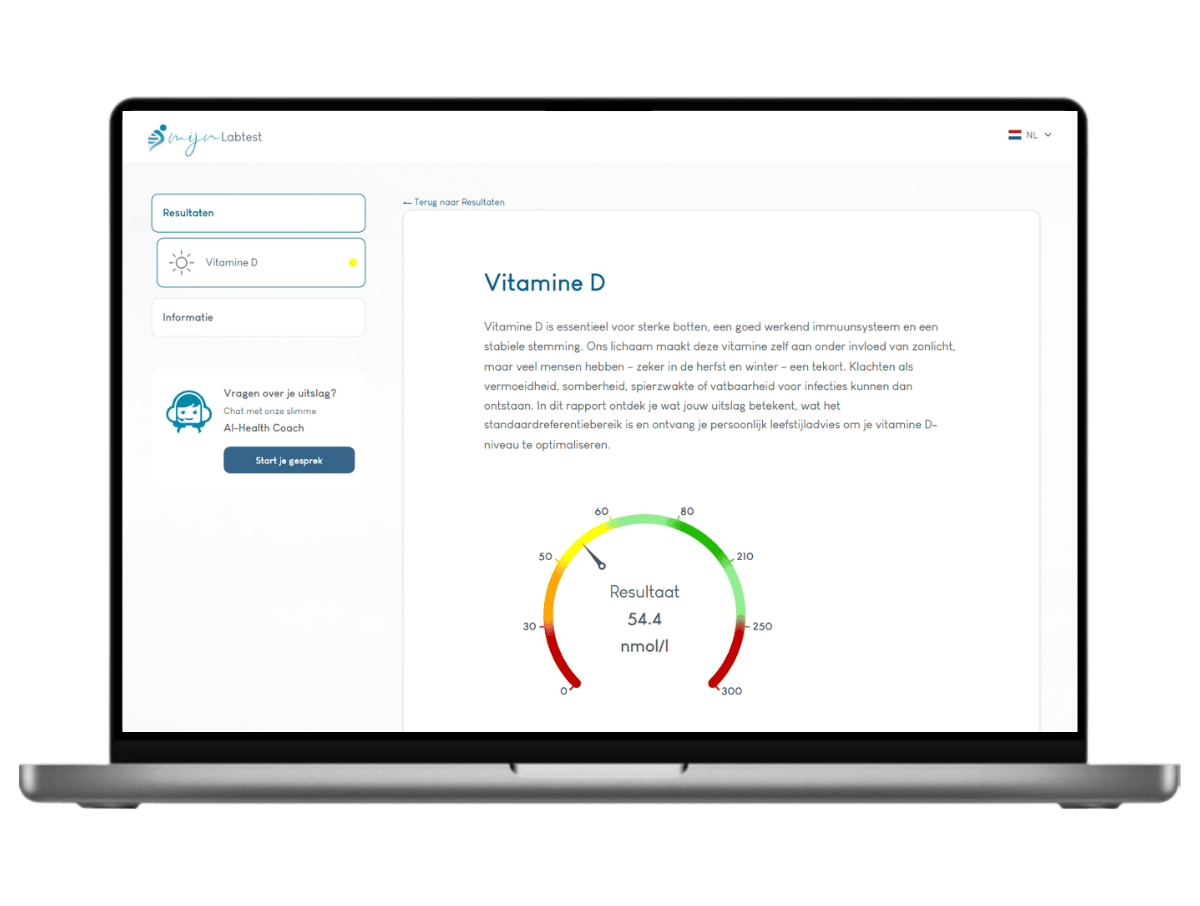Je vitamine D testen - het resultaat