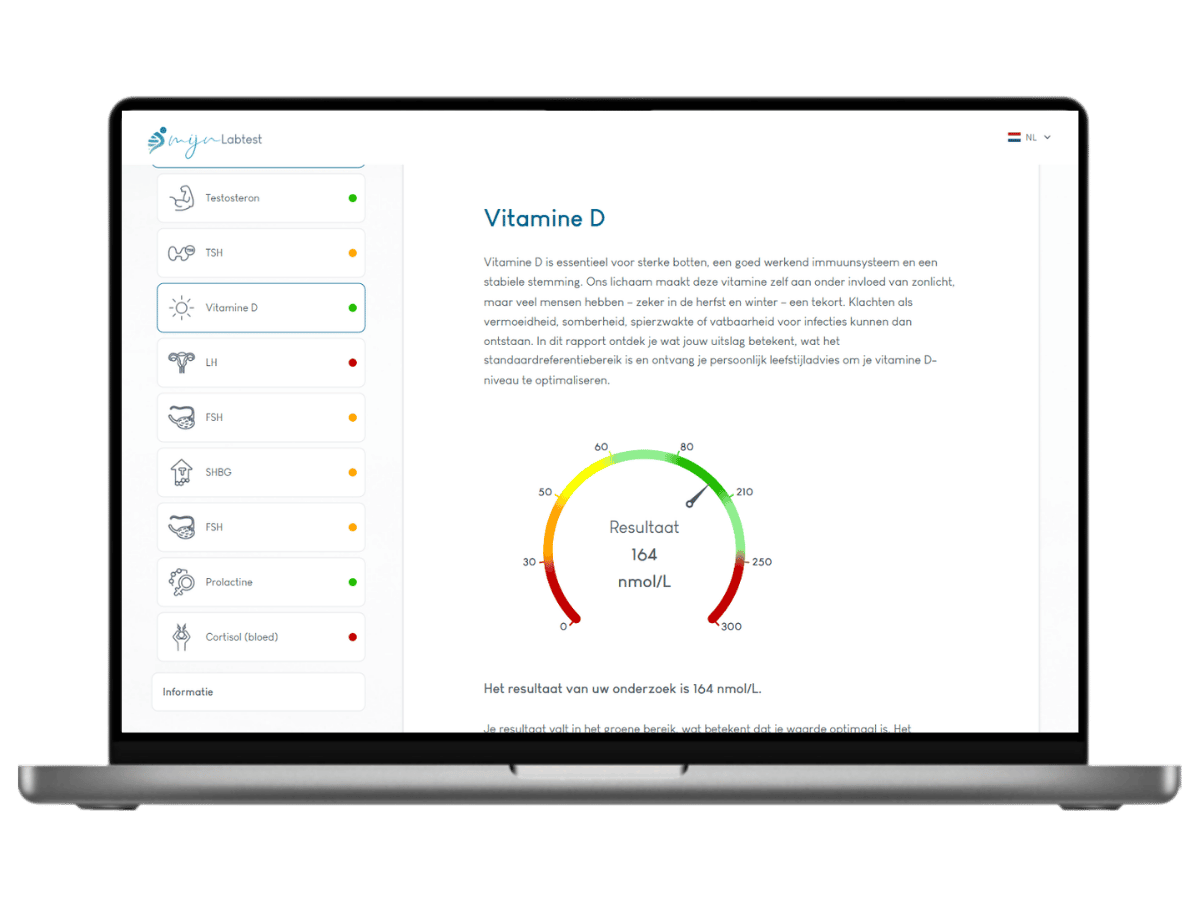 Zo ziet het resultaat van Vitamine D er uit. Het meest complete rapport met AI integratie en leefstijl advies.
