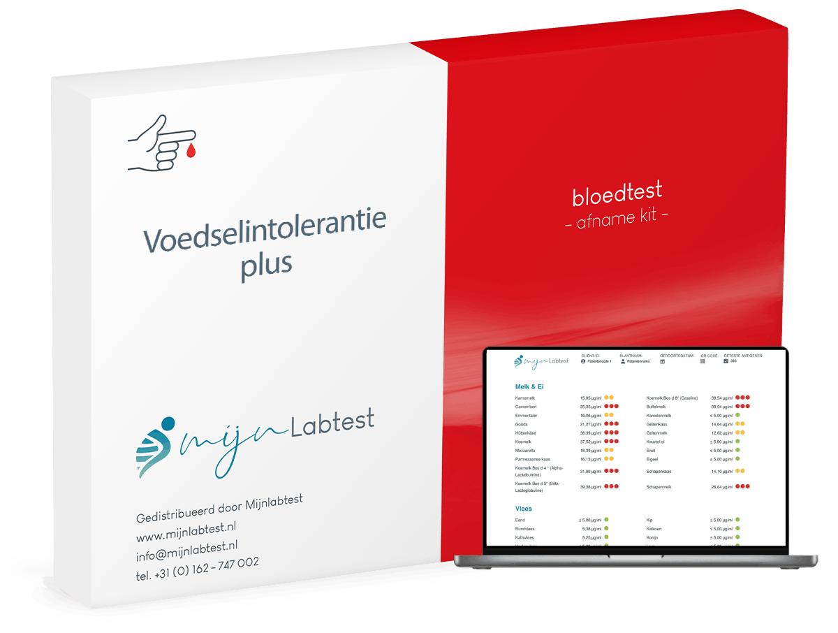 afname kit voor de voedselintolerantie test plus, dit is hoe je een sample afneemt voor de test