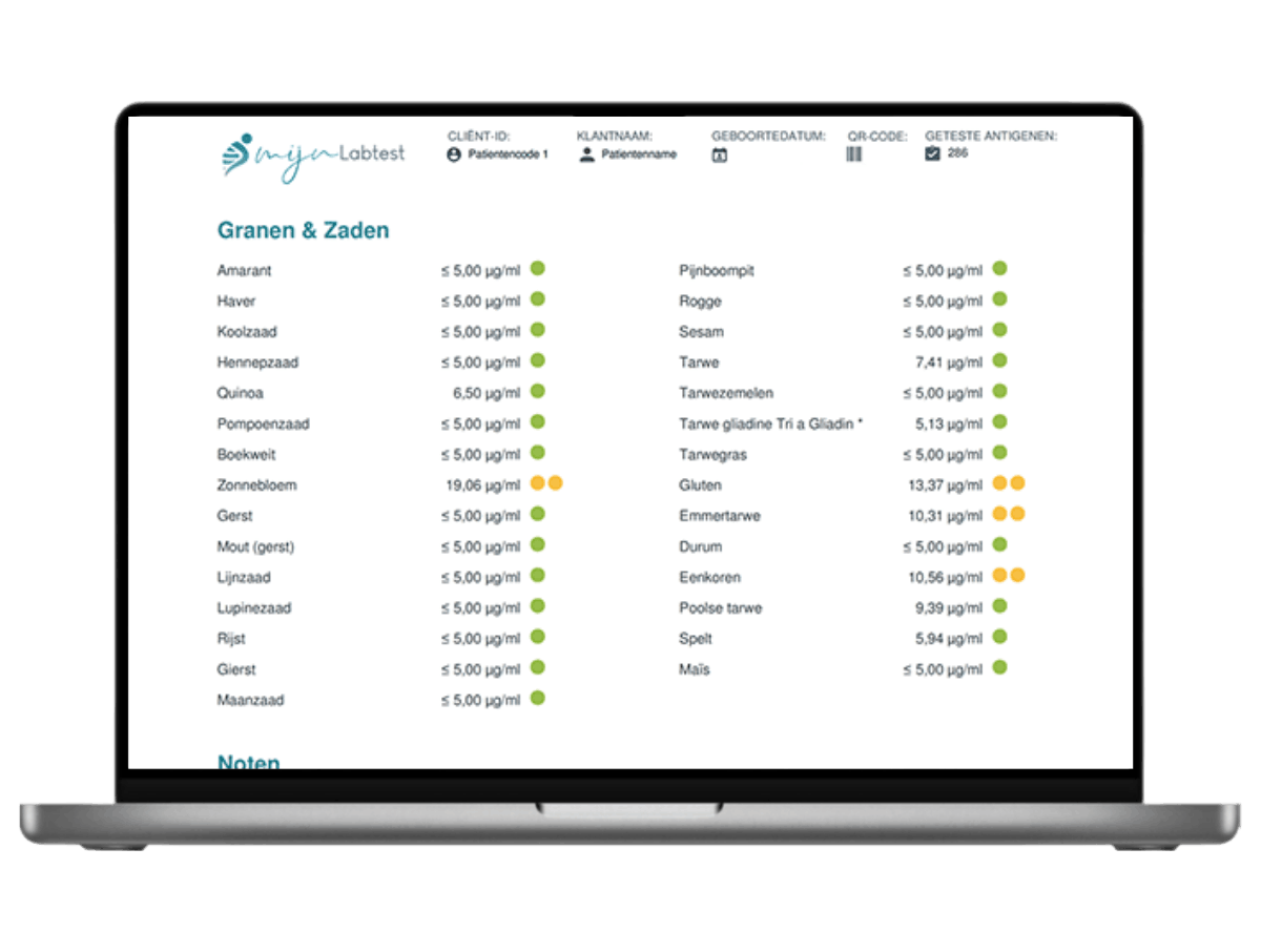hoofdstuk uit de uitslag over groenten hoofdstuk uit de uitslag over groenten
