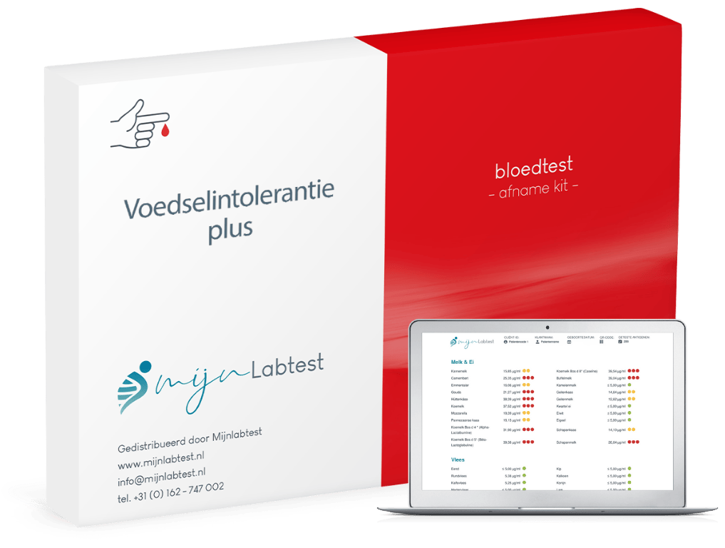 afname kit voor de voedselintolerantie test plus, dit is hoe je een sample afneemt voor de test