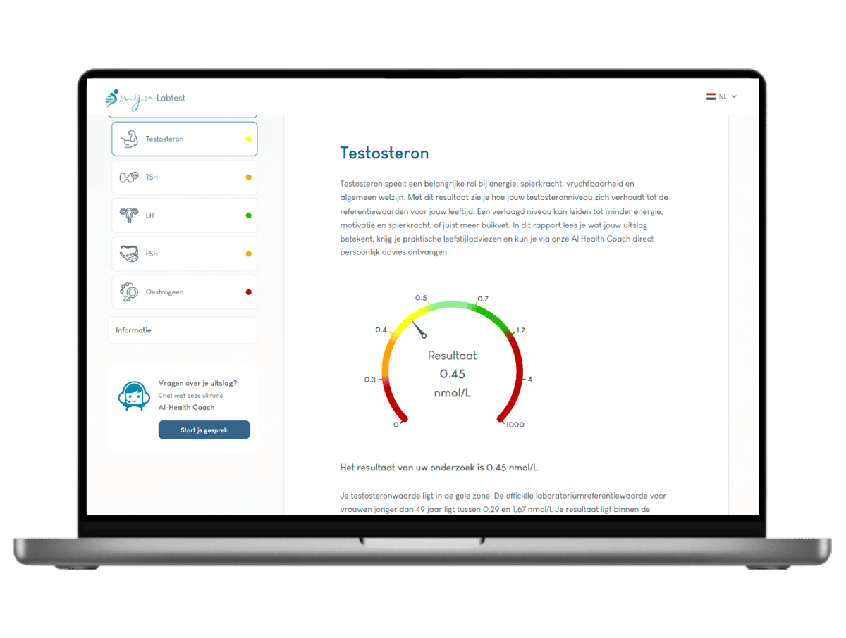 Dit is een voorbeeld van de testosteron test voor vrouwen, onderdeel van het complete hormoon profiel vrouwen bloedonderzoek. Dit is een voorbeeld van de testosteron test voor vrouwen, onderdeel van het complete hormoon profiel vrouwen bloedonderzoek.