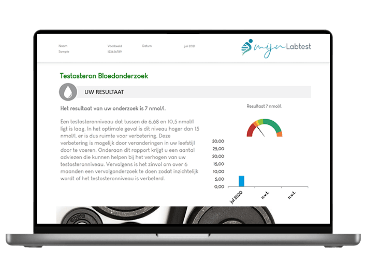 voorbeeld hormonen man speeksel onderzoek uitslag voorbeeld hormonen man speeksel onderzoek uitslag