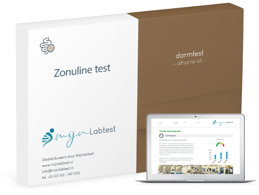 De zonuline test is er om te kijken of je een verhoogde darm doorlaatbaarheid hebt.
