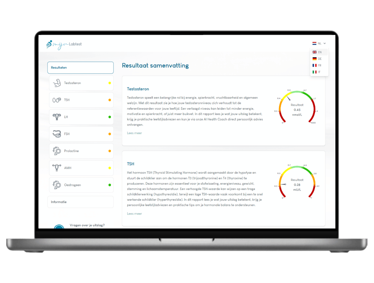 Wat je kunt doen bij PCOS symptomen