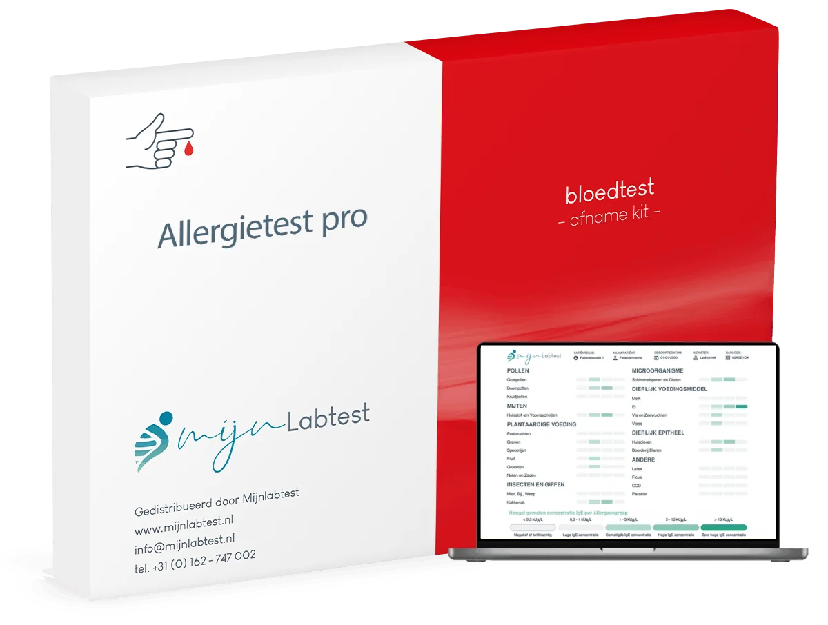 Allergietest pro