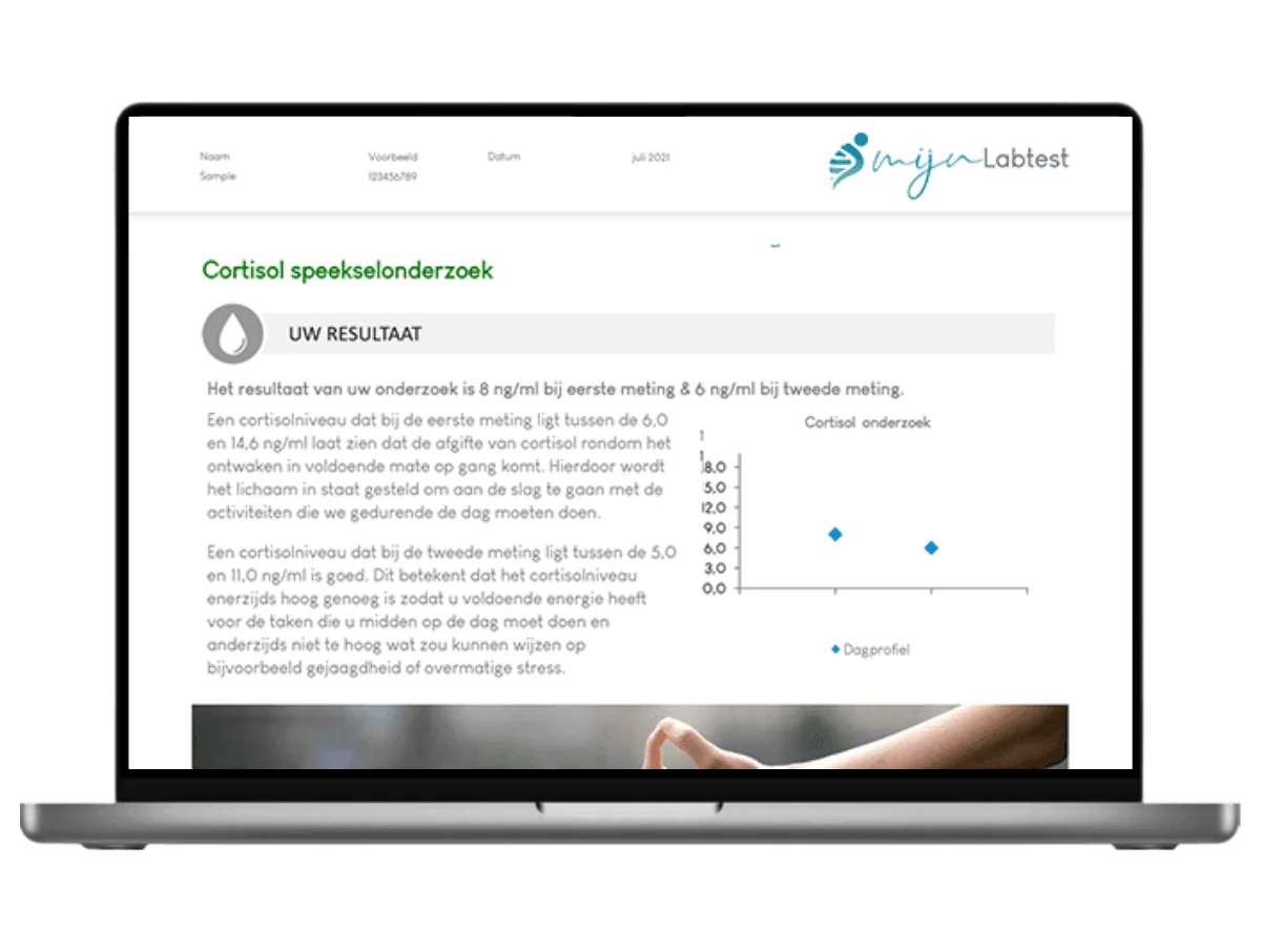 Voorbeeld van de Speekseltest hormonen man uitslag op een laptop