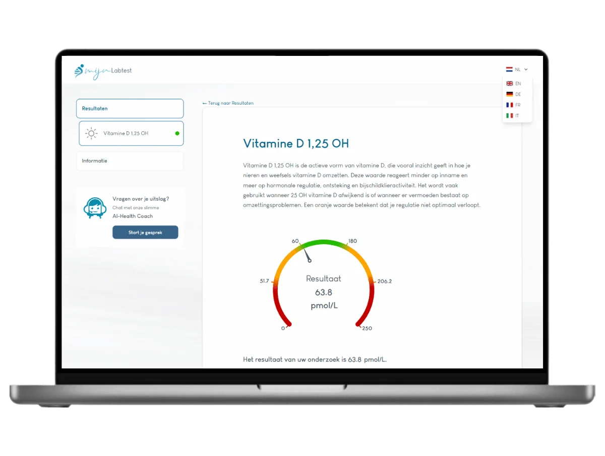 Voorbeeld van de Vitamine D 1,25-OH test uitslag op een laptop