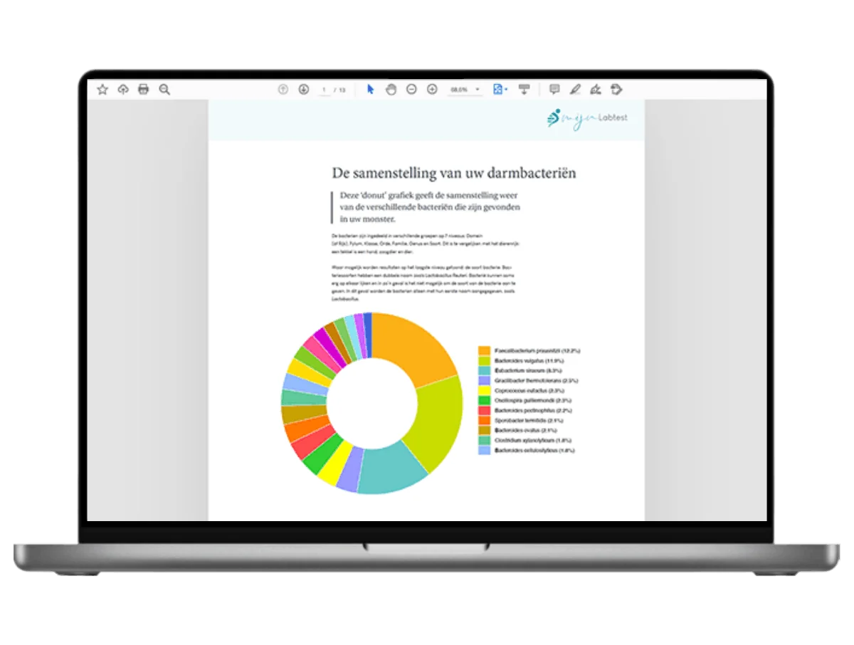 Voorbeeld van de Microbioom onderzoek XL uitslag op een laptop