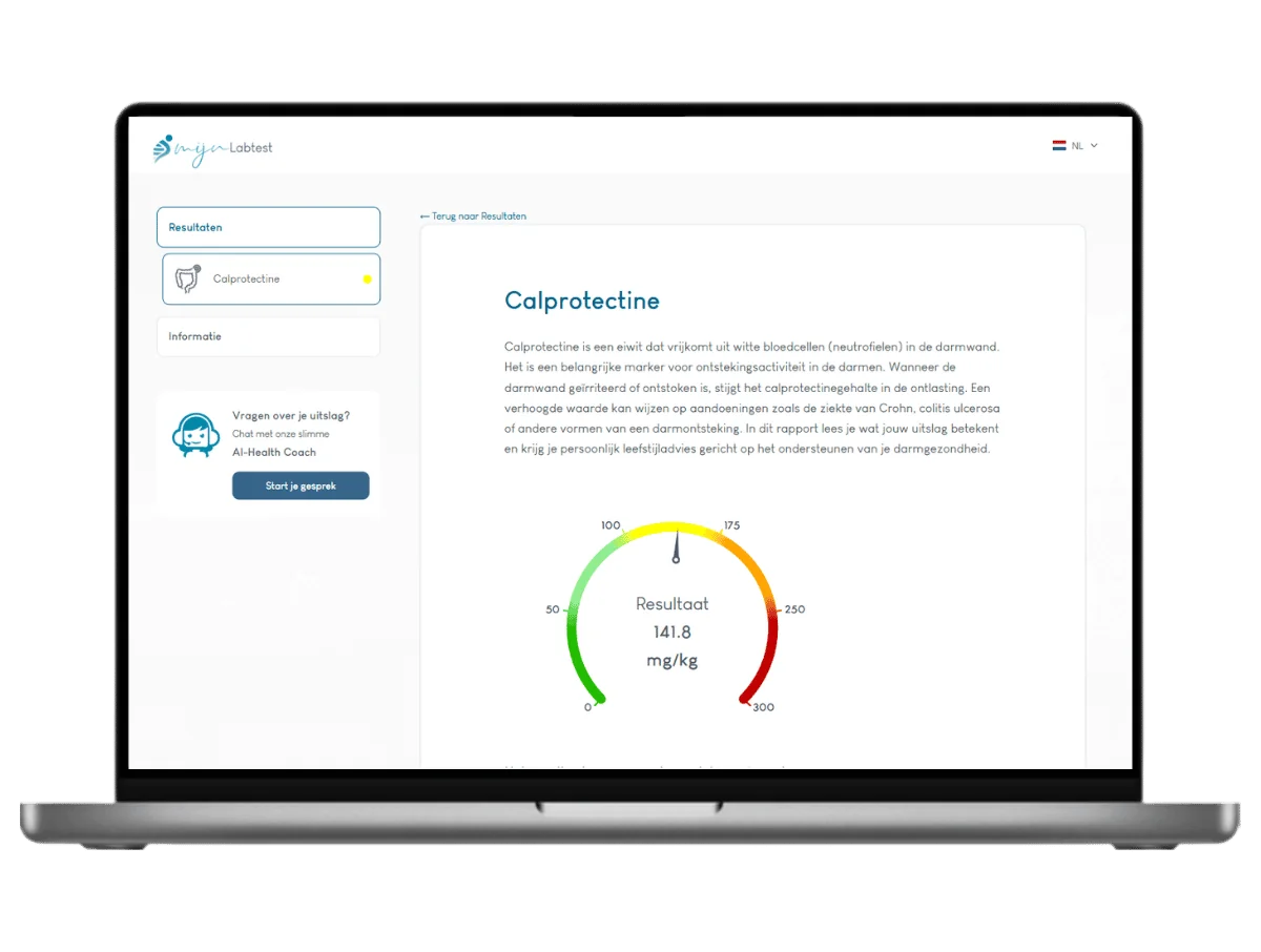 Voorbeeld van de Calprotectine waarde test uitslag op een laptop