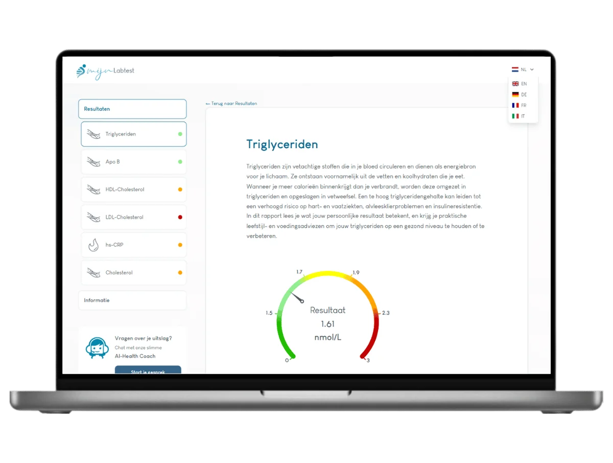 Voorbeeld van de cardio bloedtest uitslag op een laptop