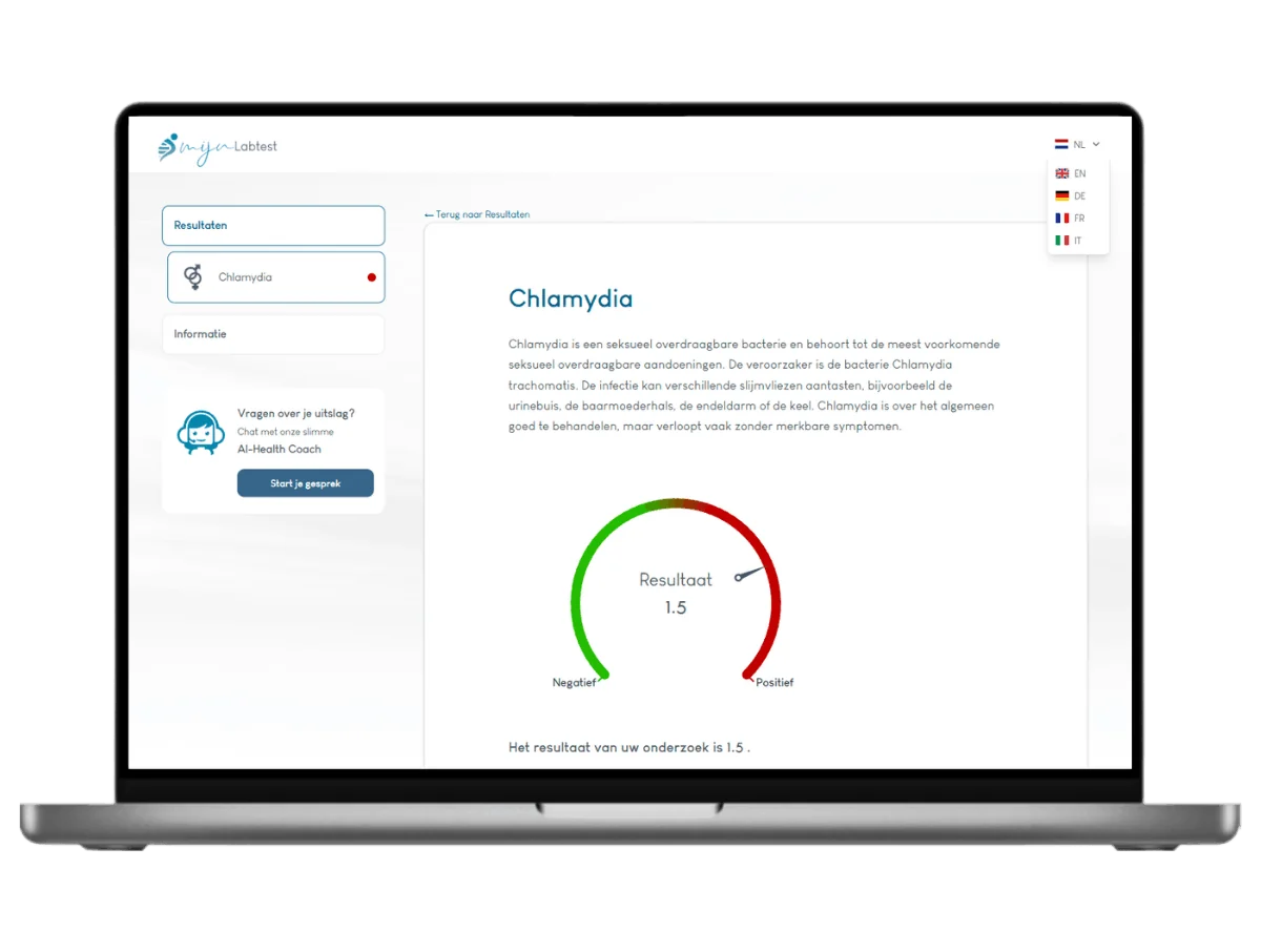 Voorbeeld van de Chlamydia test uitslag op een laptop