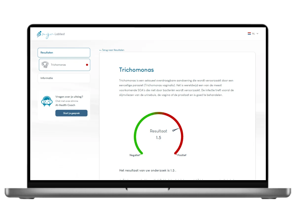 Voorbeeld van de Trichomonas test uitslag op een laptop