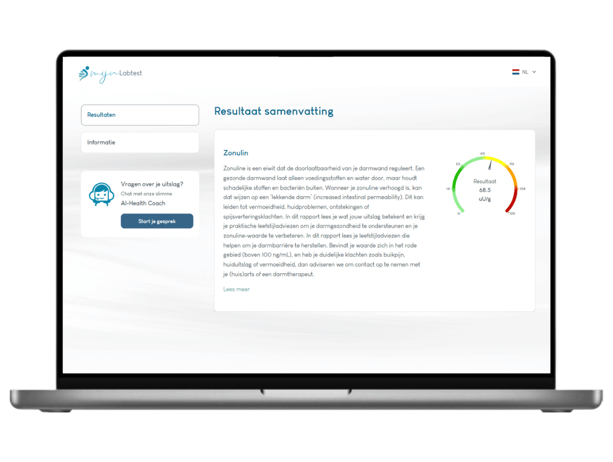 Lekkende darm testen
