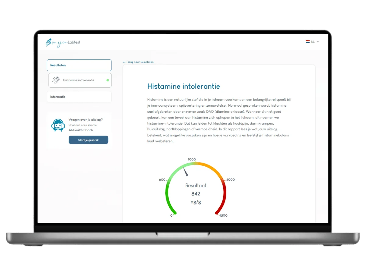 Voorbeeld van de Histamine intolerantie test uitslag op een laptop