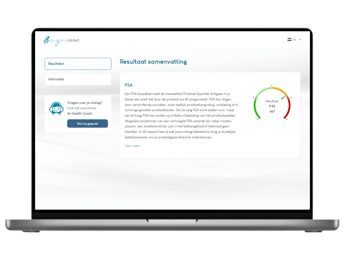 Voorbeeld van de PSA test uitslag op een laptop