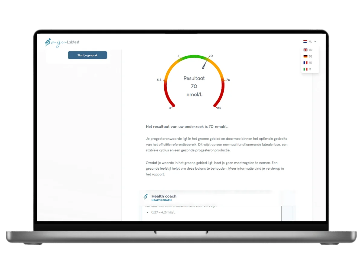 Voorbeeld van de Progesteron test vrouw uitslag op een laptop