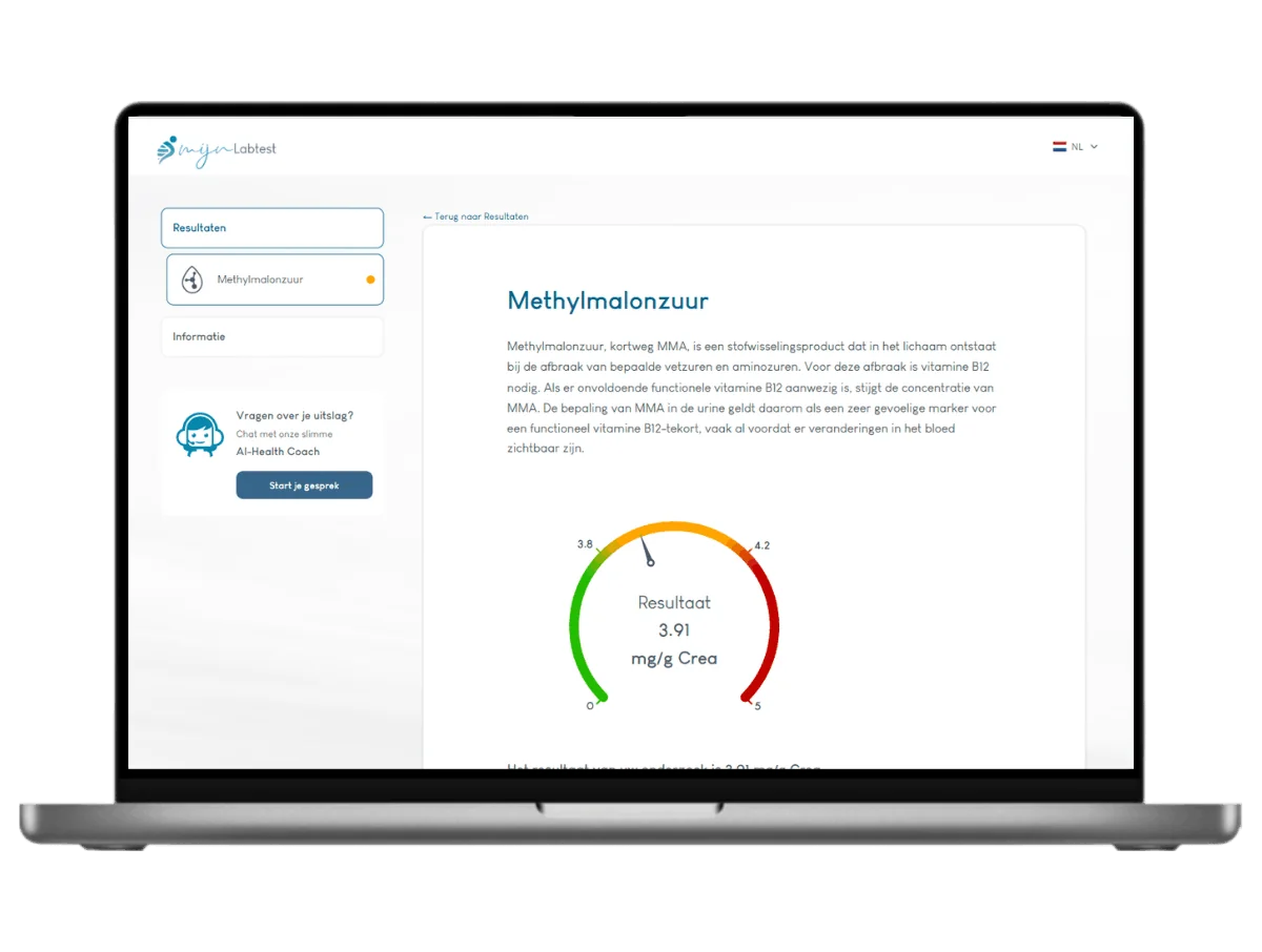 Voorbeeld van de Methylmalonzuur test (MMA) uitslag op een laptop