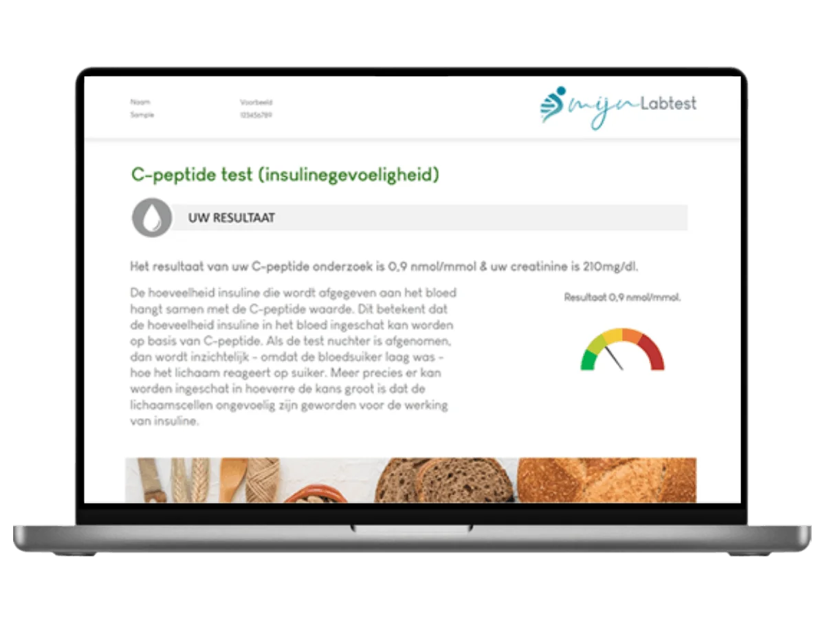 Voorbeeld van de C-peptide test uitslag op een laptop