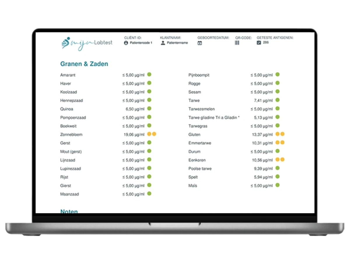 Voorbeeld van de Voedselintolerantie test basis uitslag op een laptop