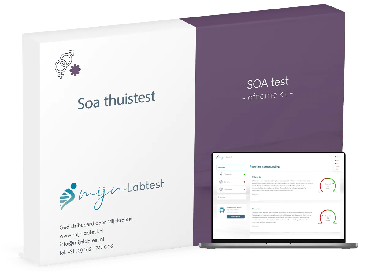 Soa test thuis
