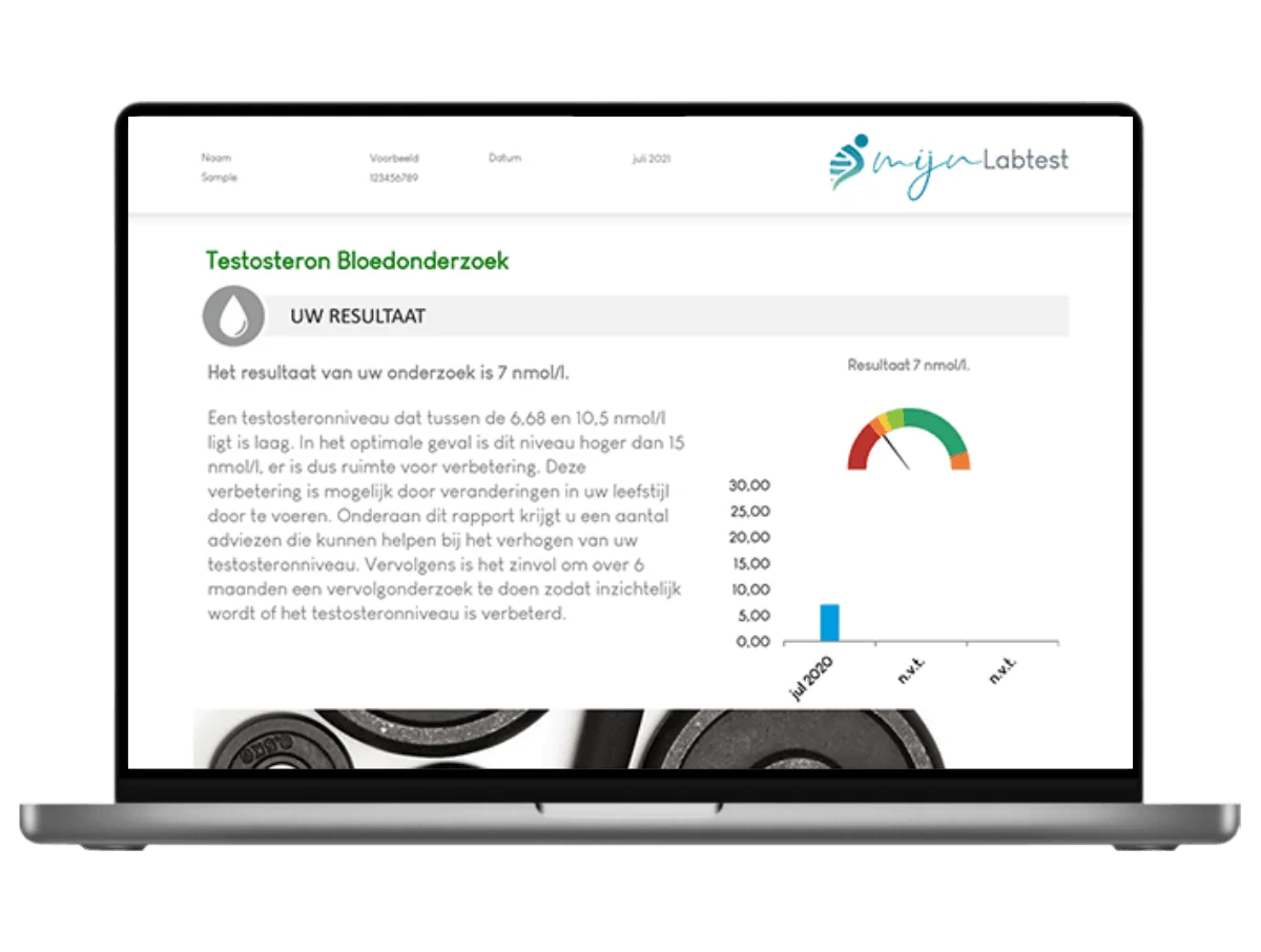 Voorbeeld van de Vrij testosteron test uitslag op een laptop