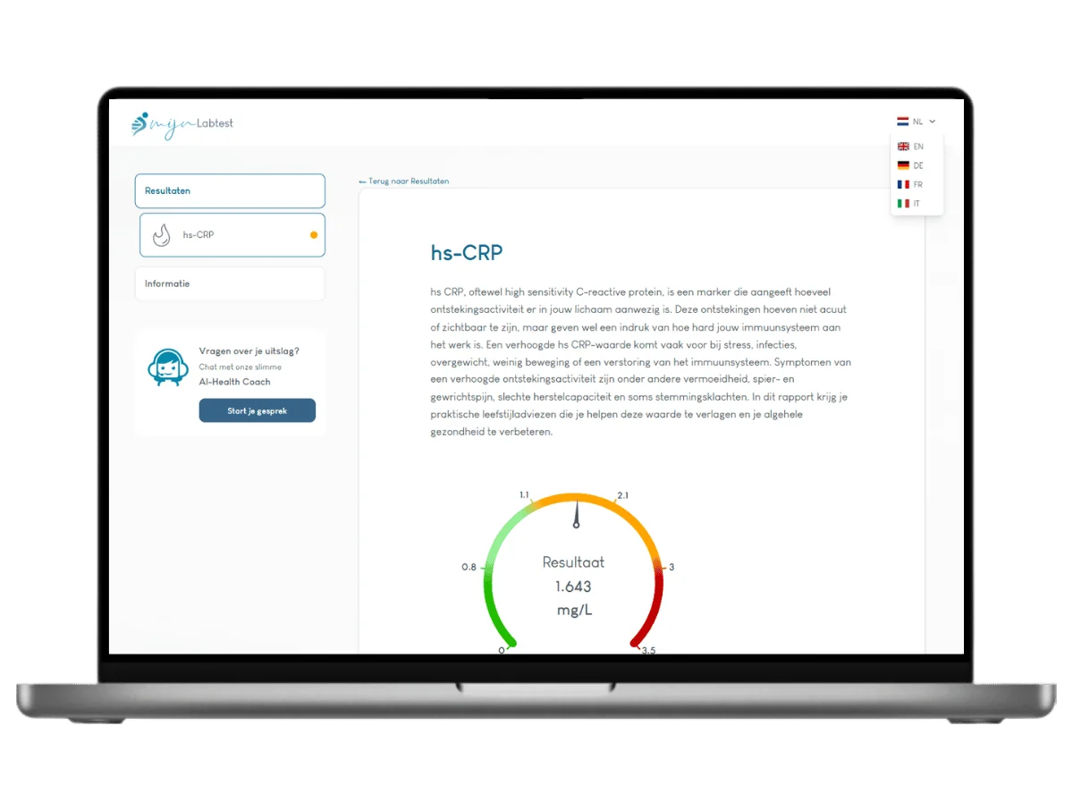 Voorbeeld van de CRP test uitslag op een laptop