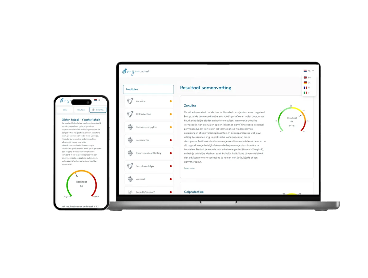 Voorbeeld van de Darmtest XL uitslag op een laptop
