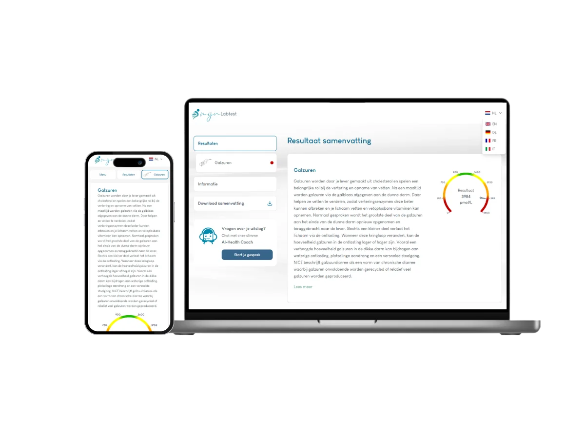 Voorbeeld van de Galzuren test uitslag op een laptop