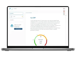 Voorbeeld van een digitale uitslag van Mijnlabtest