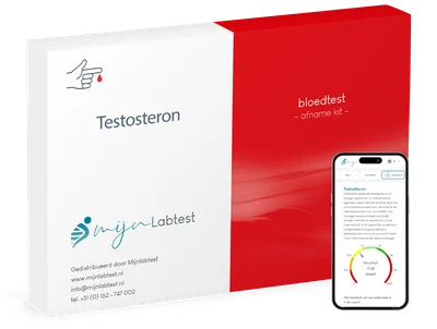 Testosteron test